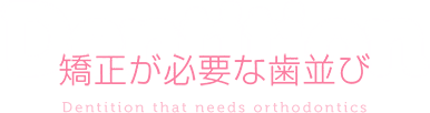 矯正が必要な歯並び Dentition that needs orthodontics